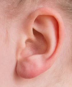 oreille gauche